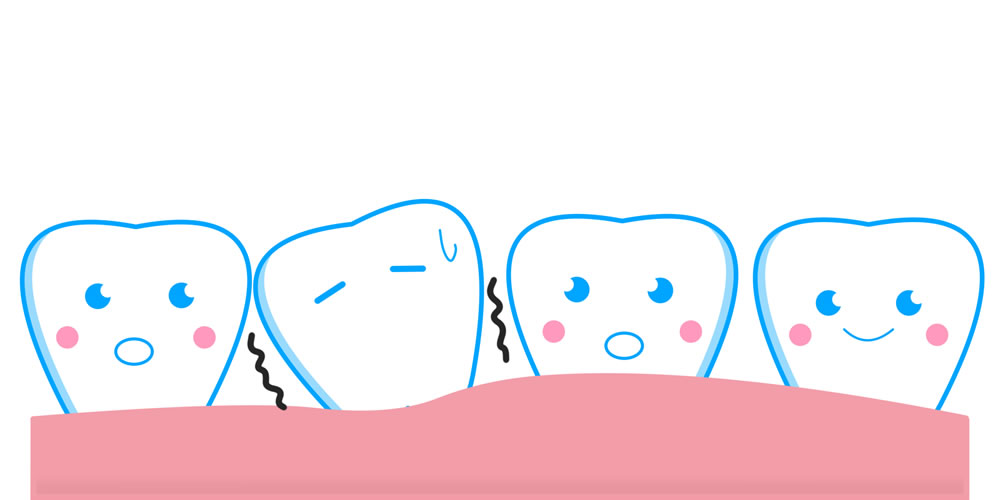 歯がグラグラする原因
